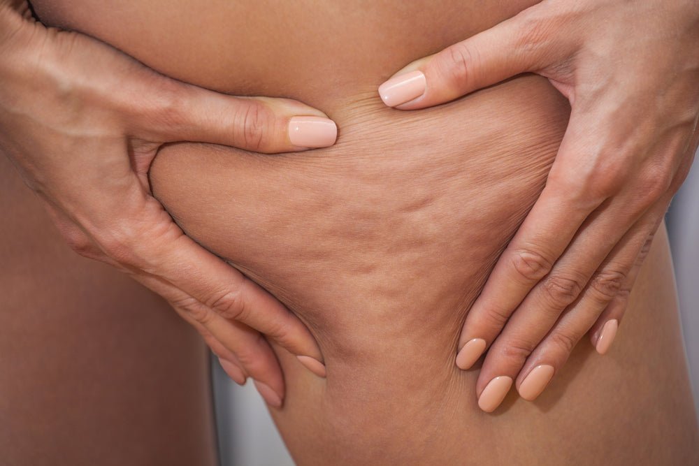 Nos Dos et Don'ts pour lutter contre la cellulite - Daylily Paris