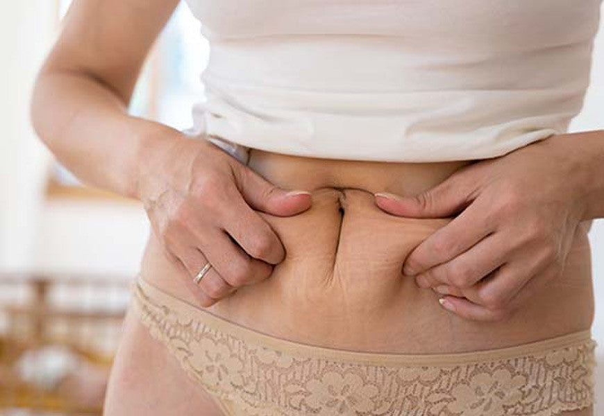 A Treatment for Post-Partum Belly Pooch