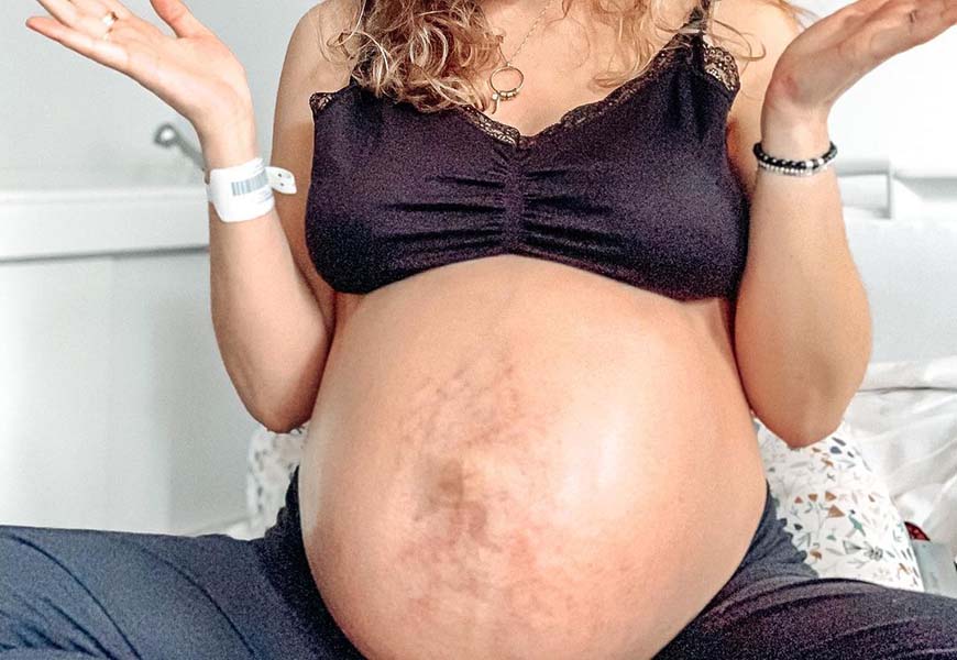 vergetures idées reçues