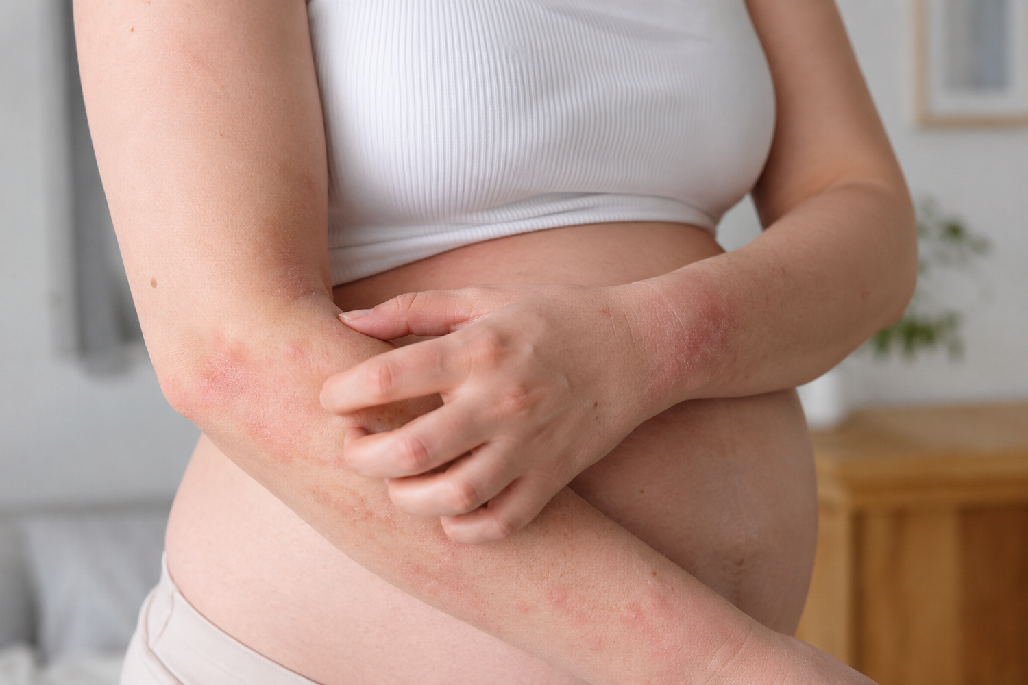 Eczéma grossesse
