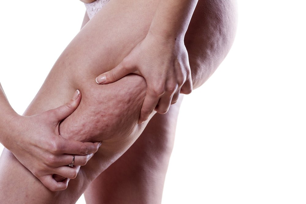 Cellulite après grossesse : quelles solutions ? - Daylily Paris