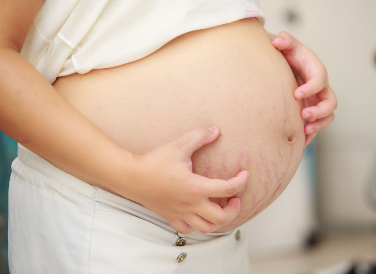 Grossesse : comment soulager la peau du ventre qui gratte ? - Daylily Paris
